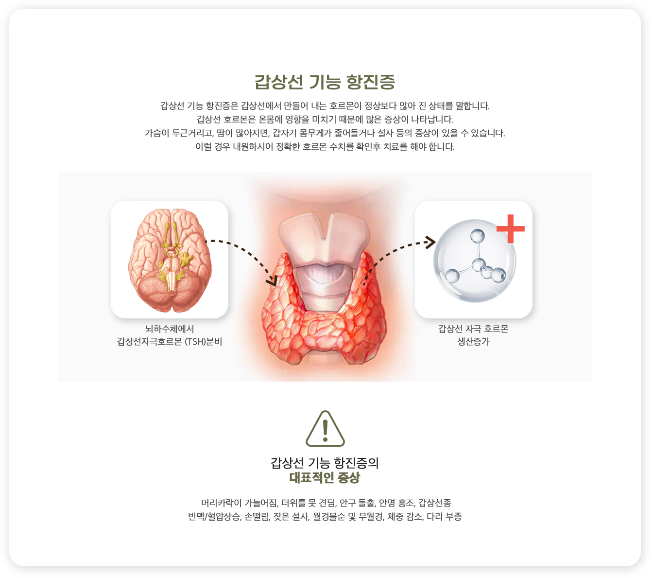 갑상선 기능 항진증