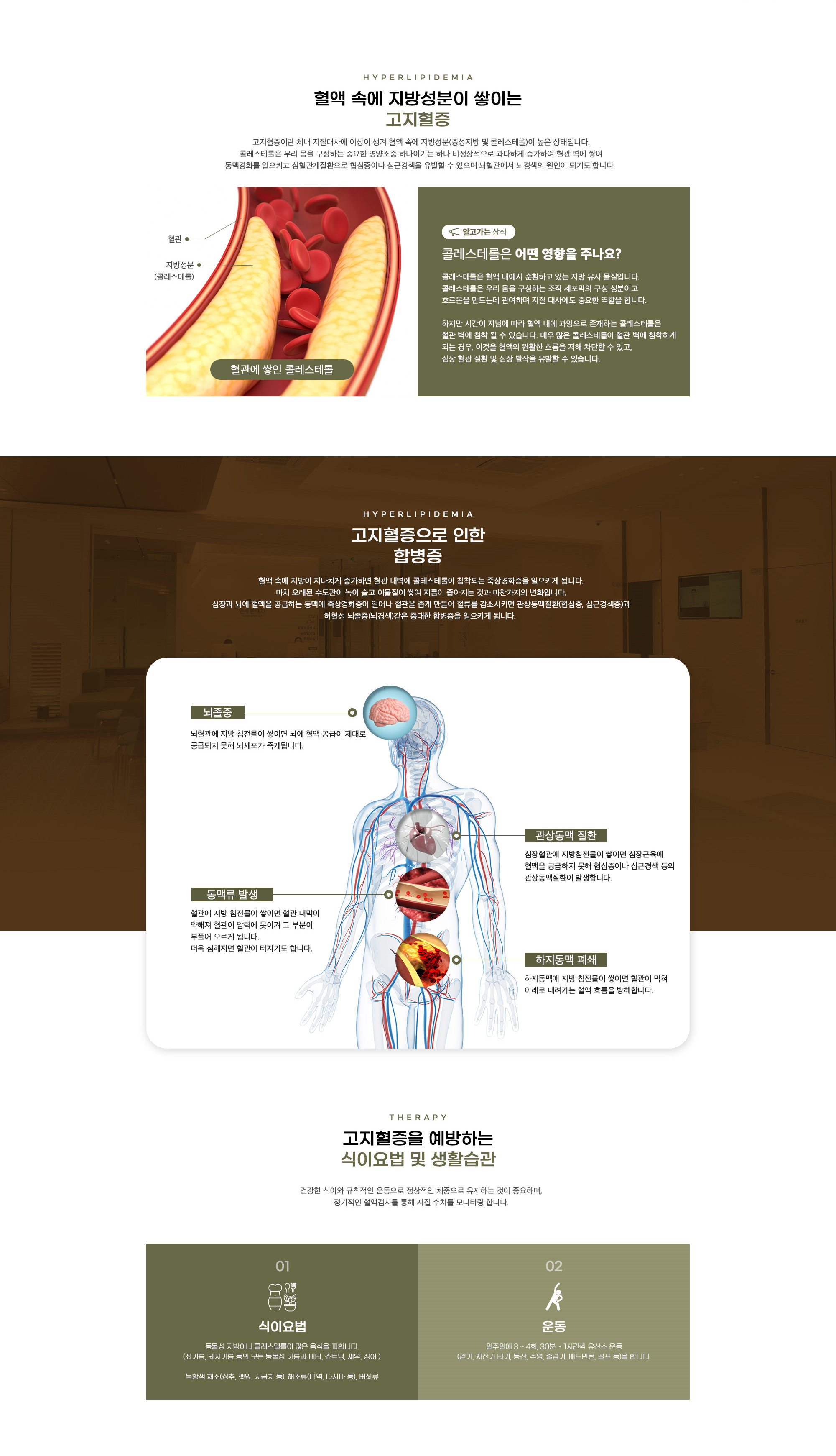 고지혈증
